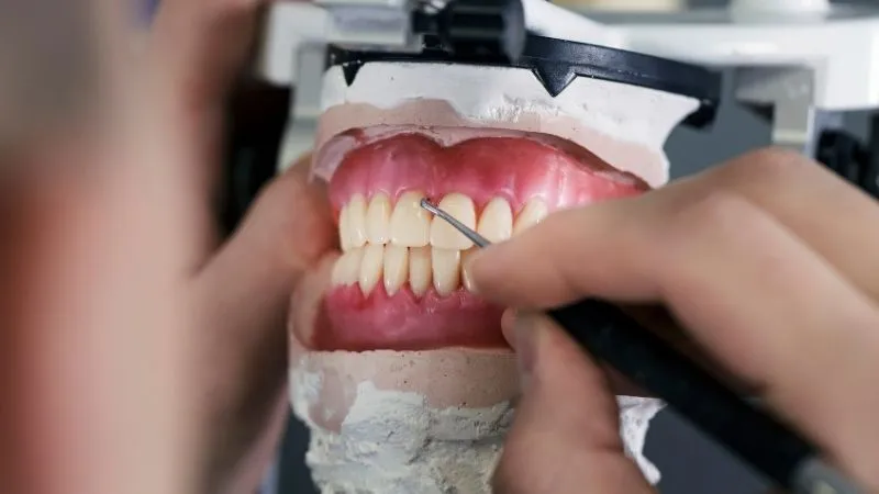 What Is The Best Material For All-On-4 Implants