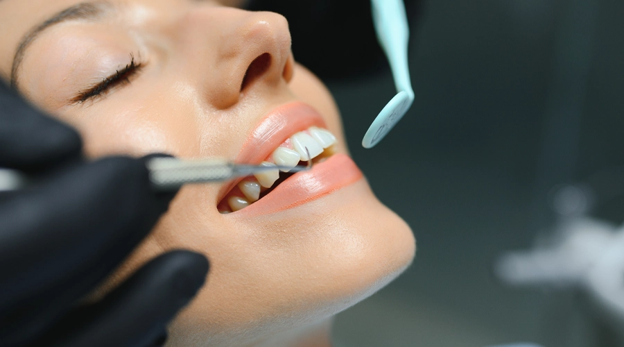 Emax Veneers emax-veneers